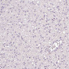 Anti-MUC5AC Antibody