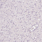 Immunohistochemical staining of human liver shows no positivity in hepatocytes as expected.