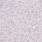 Immunohistochemical staining of human liver shows no positivity in hepatocytes as expected.