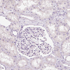 Immunohistochemical staining of human kidney shows no positivity as expected.