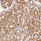 Immunohistochemical staining of human kidney shows strong cytoplasmic positivity in cells in tubules.