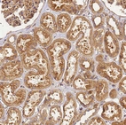 Immunohistochemical staining of human kidney shows strong cytoplasmic positivity in cells in tubules.