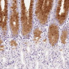 Anti-MUC5AC Antibody