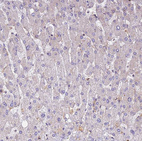 Immunohistochemical staining of human liver shows no positivity in hepatocytes.
