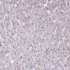 Immunohistochemical staining of human liver shows no positivity in hepatocytes.