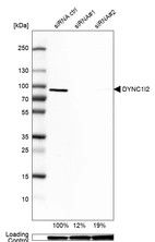 Western blot analysis in U2OS cells transfected with control siRNA, target specific siRNA probe #1 and #2, using Anti-DYNC1I2 antibody. Remaining relative intensity is presented. Loading control: Anti-GAPDH.