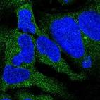 Immunofluorescent staining of human cell line HEK 293 shows positivity in cytoplasm & aggresome.