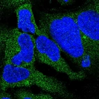 Immunofluorescent staining of human cell line HEK 293 shows positivity in cytoplasm & aggresome.