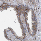 Immunohistochemical staining of human prostate shows moderate granular cytoplasmic positivity in glandular cells.