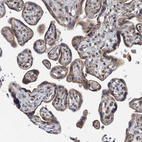 Immunohistochemical staining of human placenta shows moderate granular cytoplasmic positivity in trophoblastic cells.