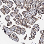 Immunohistochemical staining of human placenta shows moderate granular cytoplasmic positivity in trophoblastic cells.