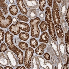 Immunohistochemical staining of human kidney shows strong granular cytoplasmic positivity in cells in tubules.