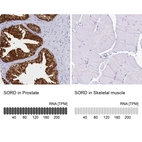 Anti-SORD Antibody