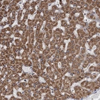 Immunohistochemical staining of human liver shows strong granular cytoplasmic positivity in hepatocytes.