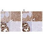Immunohistochemical staining of human kidney, liver, prostate and skeletal muscle using Anti-SORD antibody HPA040621 (A) shows similar protein distribution across tissues to independent antibody HPA040260 (B).