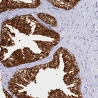 Immunohistochemical staining of human prostate shows strong cytoplasmic positivity in glandular cells.
