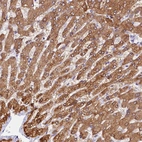 Immunohistochemical staining of human liver shows strong cytoplasmic positivity in hepatocytes.