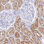 Immunohistochemical staining of human kidney shows moderate cytoplasmic positivity in cells in tubules.