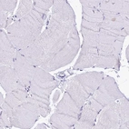 Immunohistochemical staining of human skeletal muscle shows no positivity in myocytes as expected.