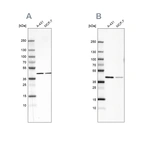 Western blot analysis using Anti-SORD antibody HPA040621 (A) shows similar pattern to independent antibody HPA040260 (B).