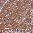 Anti-CCDC102B Antibody