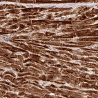 Immunohistochemical staining of human heart muscle shows strong cytoplasmic granular positivity in cardiomyocytes.