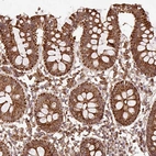 Immunohistochemical staining of human colon shows strong cytoplasmic granular positivity in glandular cells.