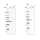 Western blot analysis using Anti-ATP5A1 antibody HPA040622 (A) shows similar pattern to independent antibody HPA044202 (B).