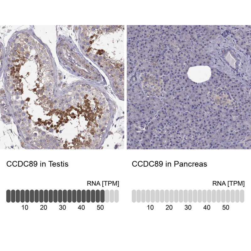 Anti-CCDC89 Antibody