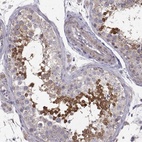 Immunohistochemical staining of human testis shows high expression.