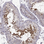 Immunohistochemical staining of human testis shows high expression.