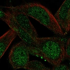 Immunofluorescent staining of human cell line RH-30 shows localization to nucleoplasm.