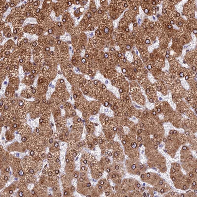 Anti-TMPRSS7 Antibody