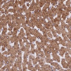 Anti-TMPRSS7 Antibody
