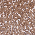 Anti-TMPRSS7 Antibody