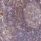 Anti-WDFY4 Antibody