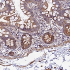 Immunohistochemical staining of human small intestine shows moderate cytoplasmic positivity in glandular cells.