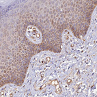 Immunohistochemical staining of human skin shows moderate cytoplasmic positivity in squamous epithelial cells.