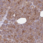 Immunohistochemical staining of human pancreas shows moderate cytoplasmic positivity in exocrine glandular cells.
