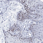 Anti-NUDT13 Antibody