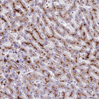 Anti-THRSP Antibody