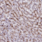Anti-THRSP Antibody