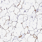 Immunohistochemical staining of human breast shows strong nuclear and cytoplasmic positivity in adipocytes.