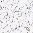 Immunohistochemical staining of human breast shows strong nuclear and cytoplasmic positivity in adipocytes.