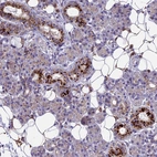 Immunohistochemical staining of human salivary gland shows moderate cytoplasmic positivity in glandular cells and adipocytes.