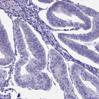 Immunohistochemical staining of human endometrium shows no cytoplasmic positivity in glandular cells as expected.