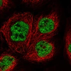 Immunofluorescent staining of human cell line A-431 shows localization to nucleoplasm.