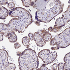 Immunohistochemical staining of human placenta shows moderate granular cytoplasmic positivity in trophoblastic cells.