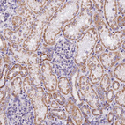 Immunohistochemical staining of human kidney shows moderate granular cytoplasmic positivity in cells in tubules.