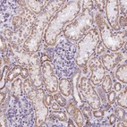 Immunohistochemical staining of human kidney shows moderate granular cytoplasmic positivity in cells in tubules.